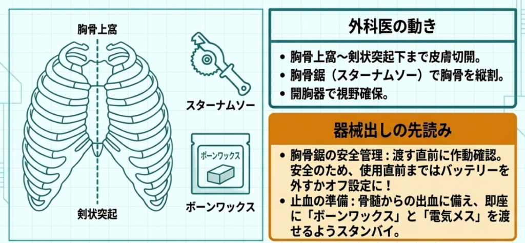 胸骨正中切開の解説画像