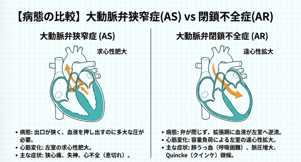どんな病気で行われる?(AS・AR)の解説画像
