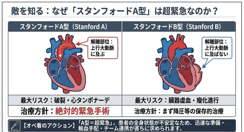 大動脈解離のスタンフォード分類を知っておこうの解説画像