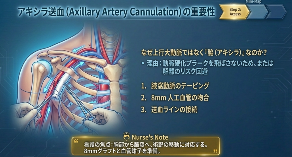 アキシラ送血（腋窩動脈送血）が必要な場合の解説画像