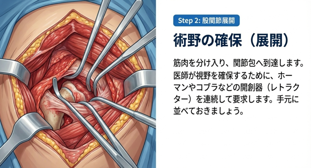 器械出し看護ポイントの解説画像
