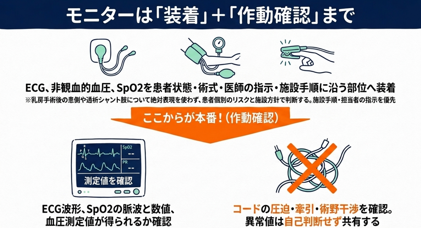 手術室でモニターを装着して波形と測定値を確認する流れ