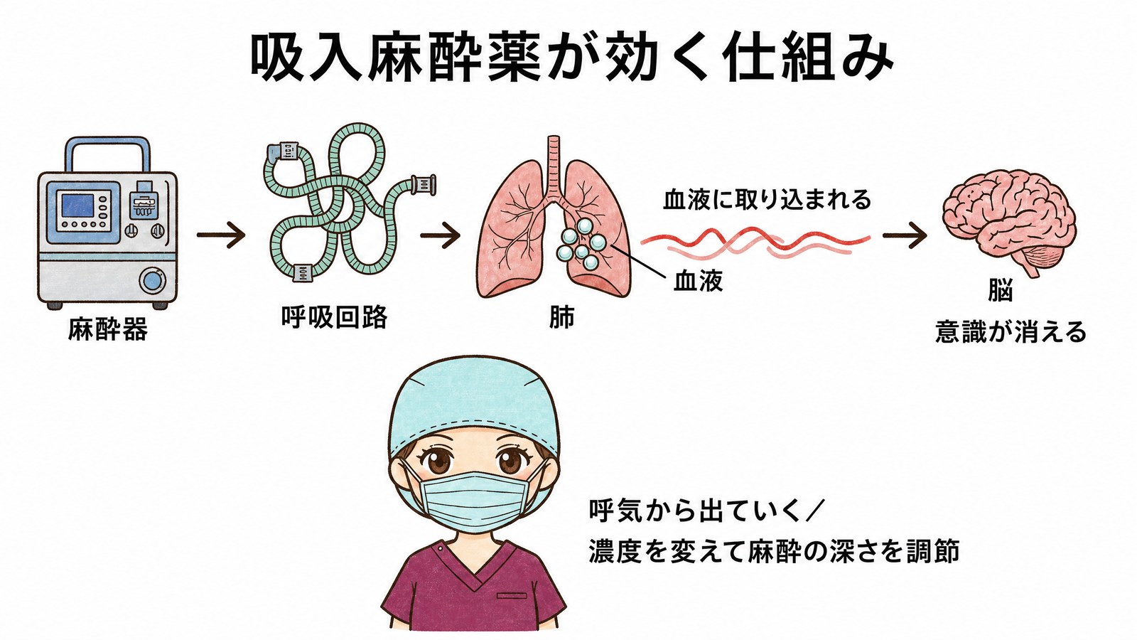 吸入麻酔薬が効く仕組みの図。麻酔器から肺に入り、肺胞から血液に移り、脳に届いて意識が消える。呼気から出ていくため濃度を変えれば深さを調節できる
