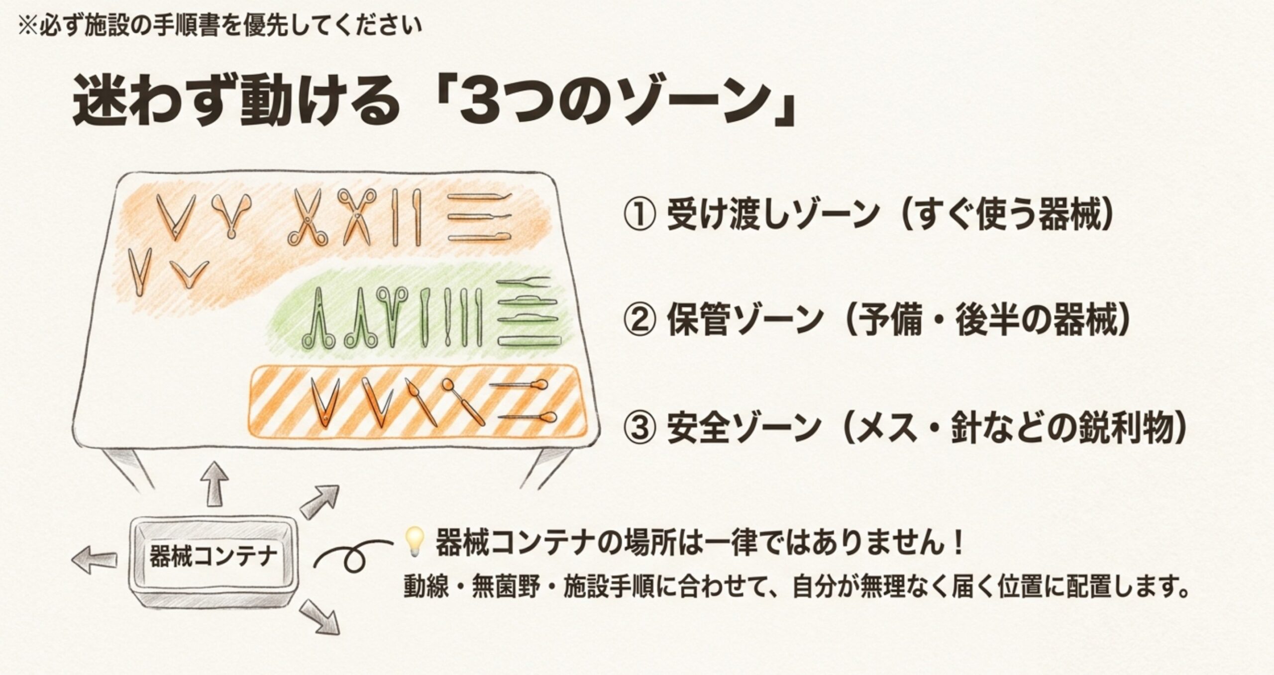 器械台を受け渡し・保管・安全の3ゾーンに分ける手書き図解