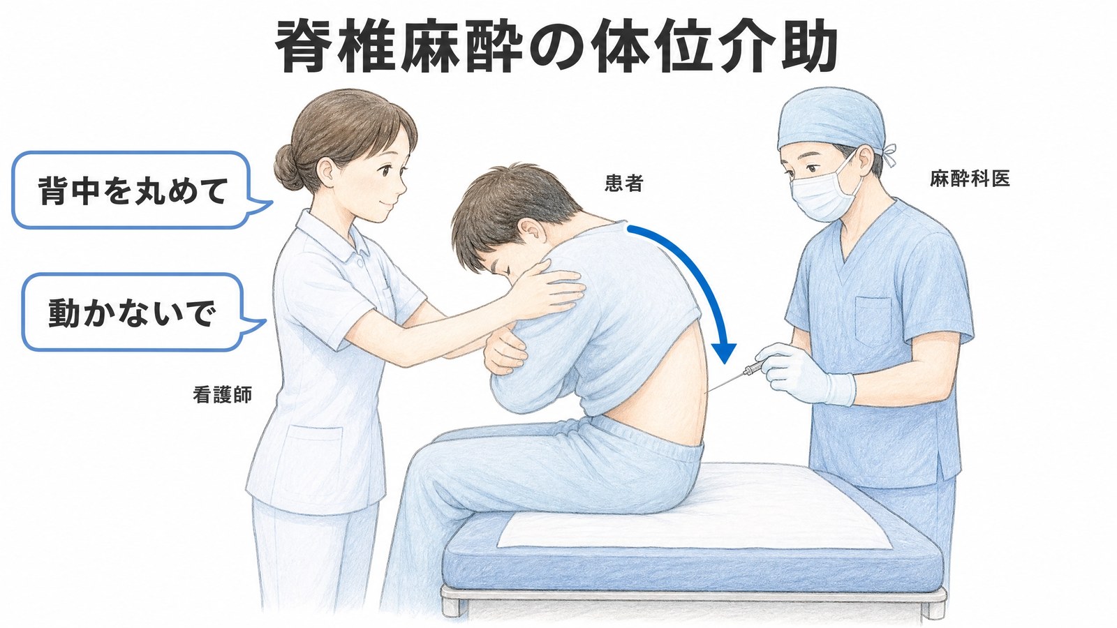 脊椎麻酔の体位介助。座位で背中を丸めた患者を看護師が正面から支え、麻酔科医が背側から穿刺する図