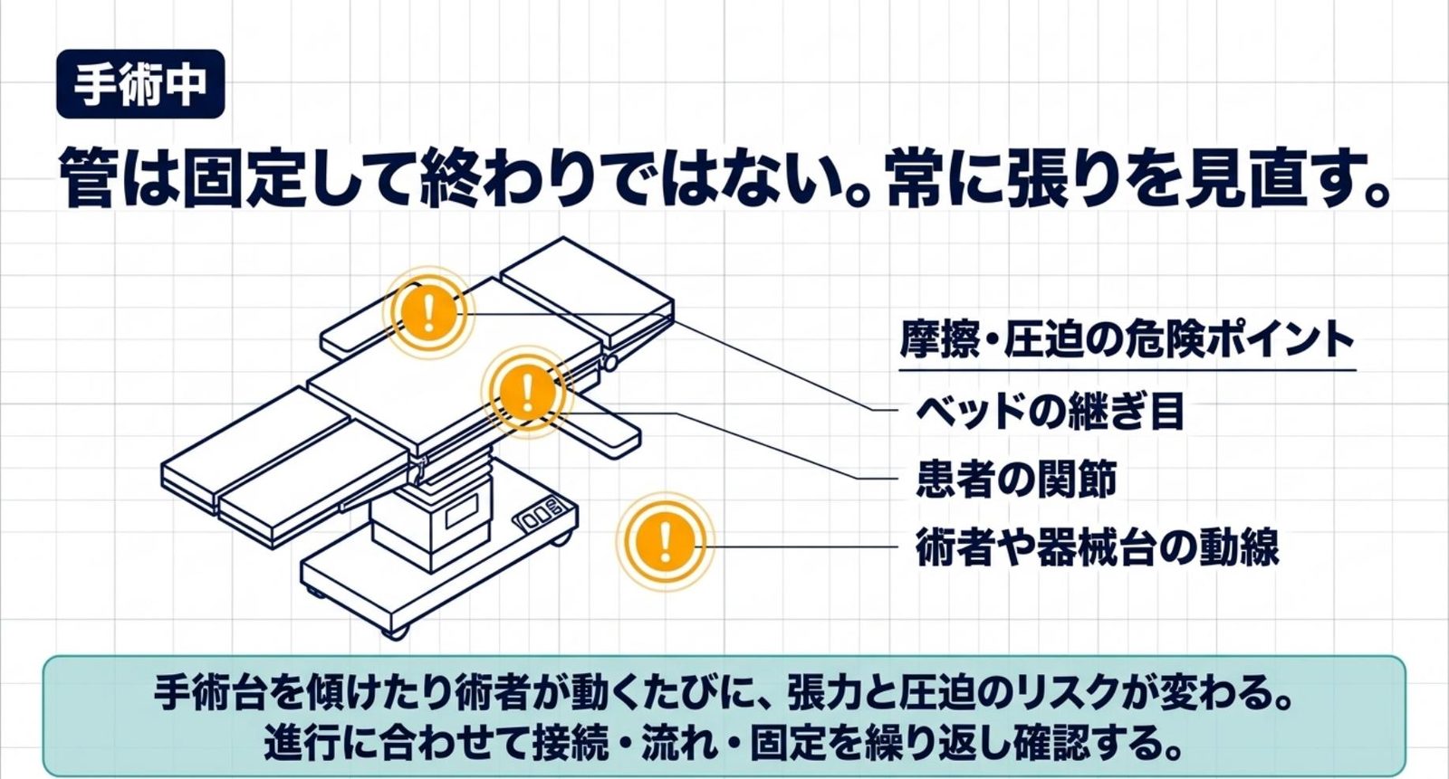 体位変換や手術台操作後に管の張力と圧迫を再確認するスライド