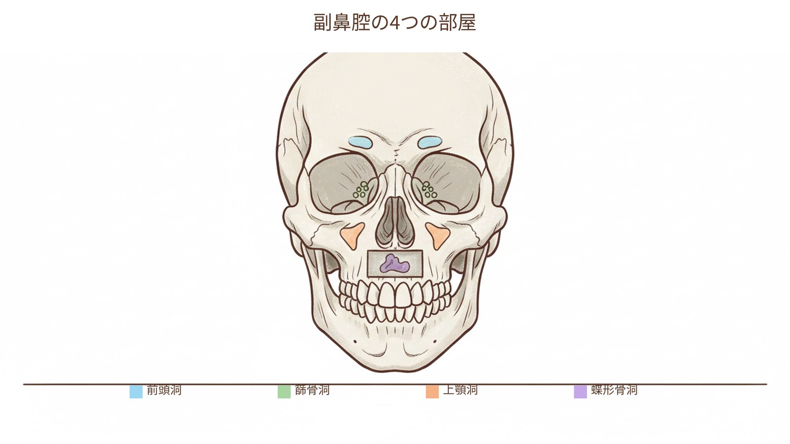 副鼻腔の4つの部屋の図。前頭洞、篩骨洞、上顎洞、蝶形骨洞の位置を顔の正面と側面で示す