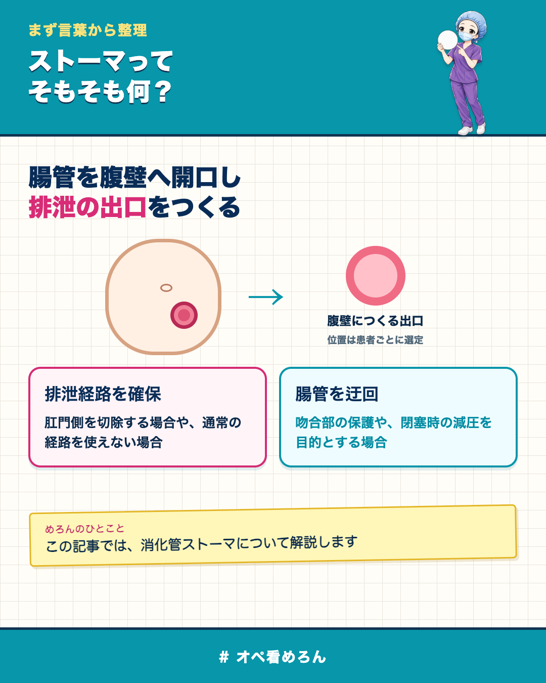 腹壁に消化管ストーマを造設して排泄の出口とする概念と主な目的を示した図