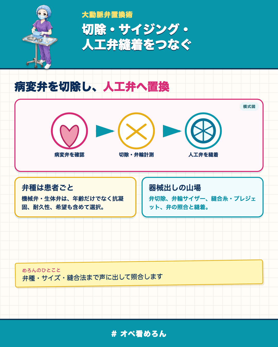 大動脈弁置換術で病変弁の切除・弁輪計測・人工弁縫着を示した模式図