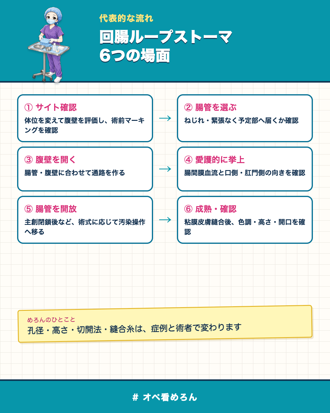 回腸ループストーマのサイト確認から成熟までの代表的な6段階を示した図