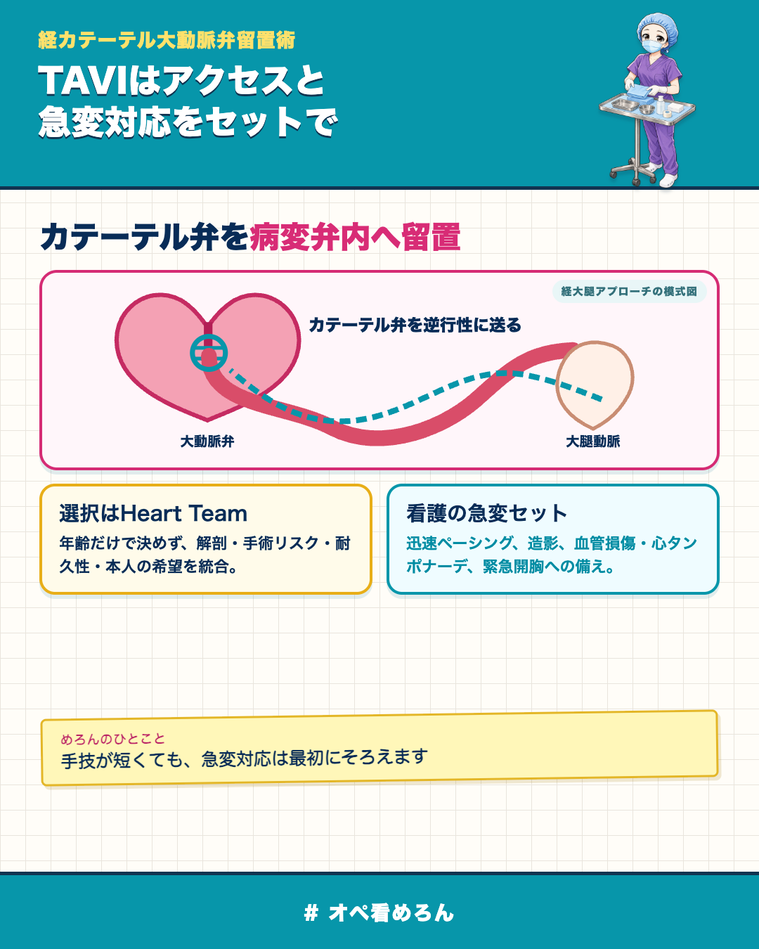 TAVIで大腿動脈から病変大動脈弁へカテーテル弁を送る経路の模式図