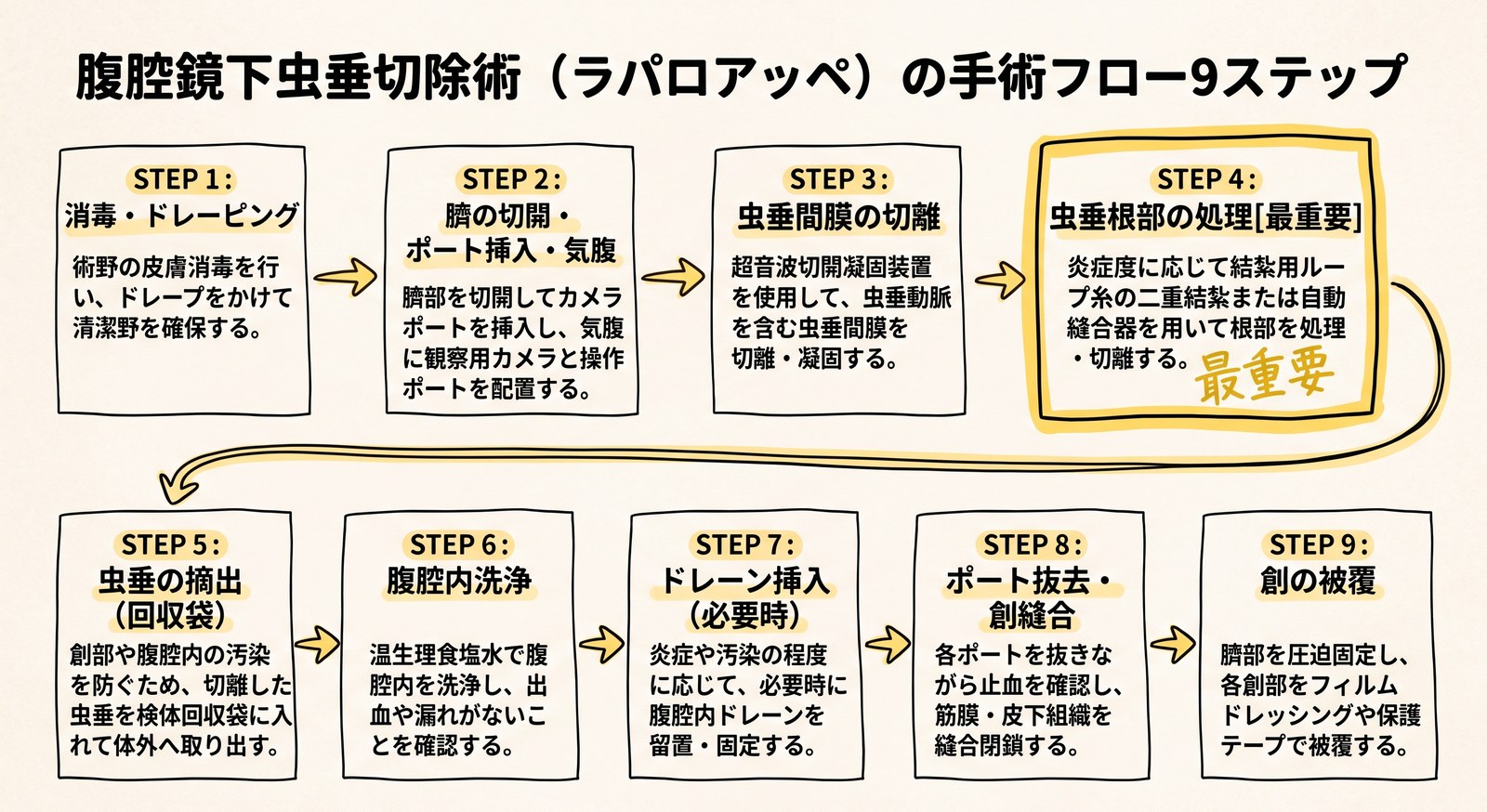 腹腔鏡下虫垂切除術の流れ9ステップ(消毒・ドレーピング、臍の切開とポート挿入・気腹、虫垂間膜の切離、虫垂根部の処理、回収袋での摘出、腹腔内洗浄、ドレーン挿入、ポート抜去と創縫合、創の被覆)の図